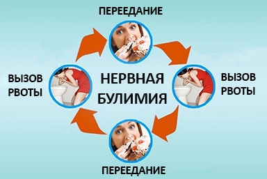 Лечение булимии в Киришах